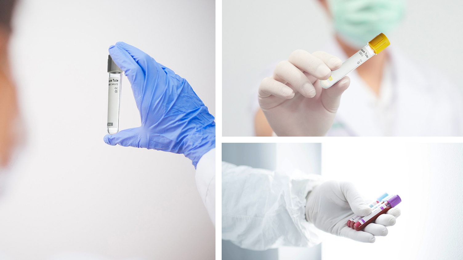 Application scenarios of blood collection tubes