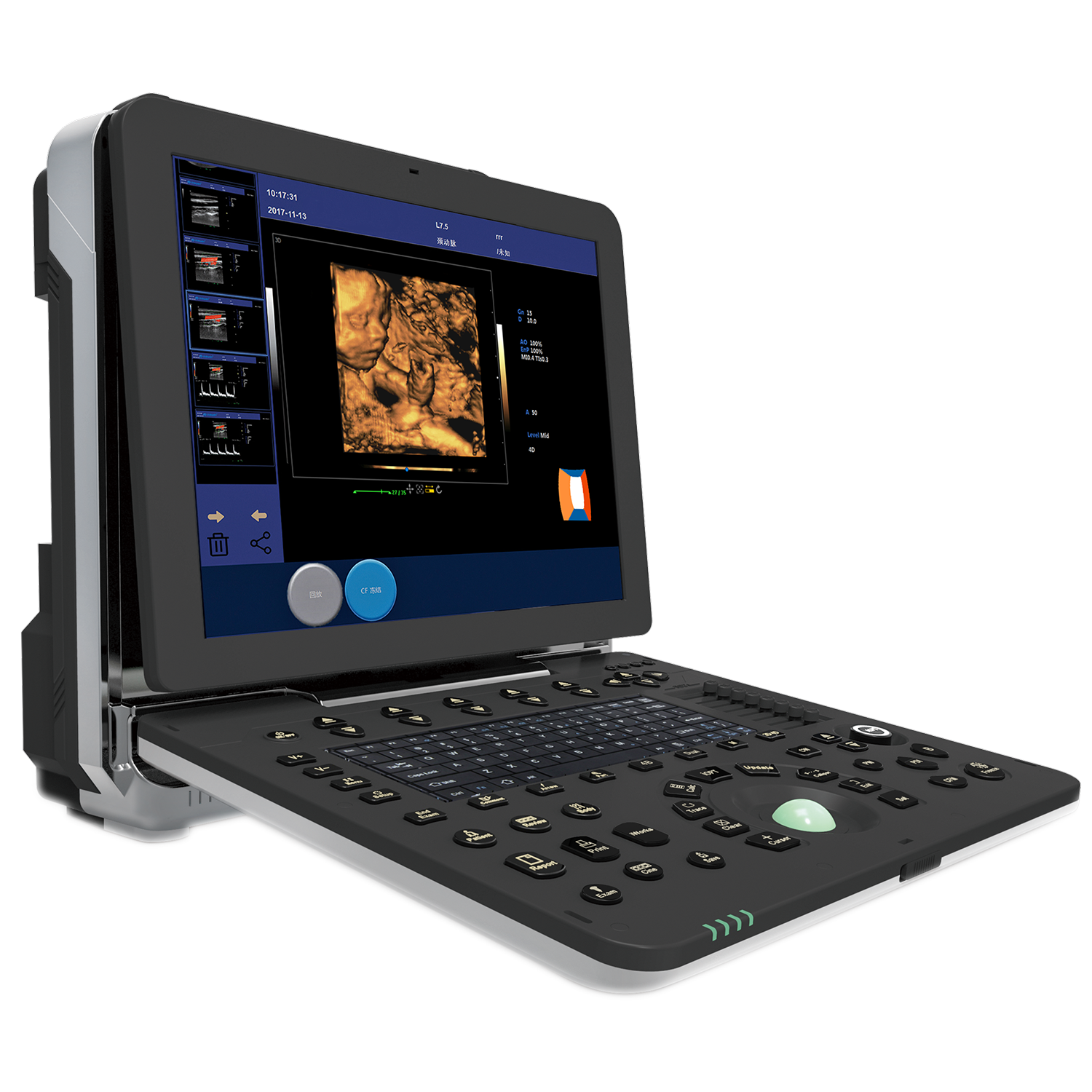 Ultrasound Diagnotic