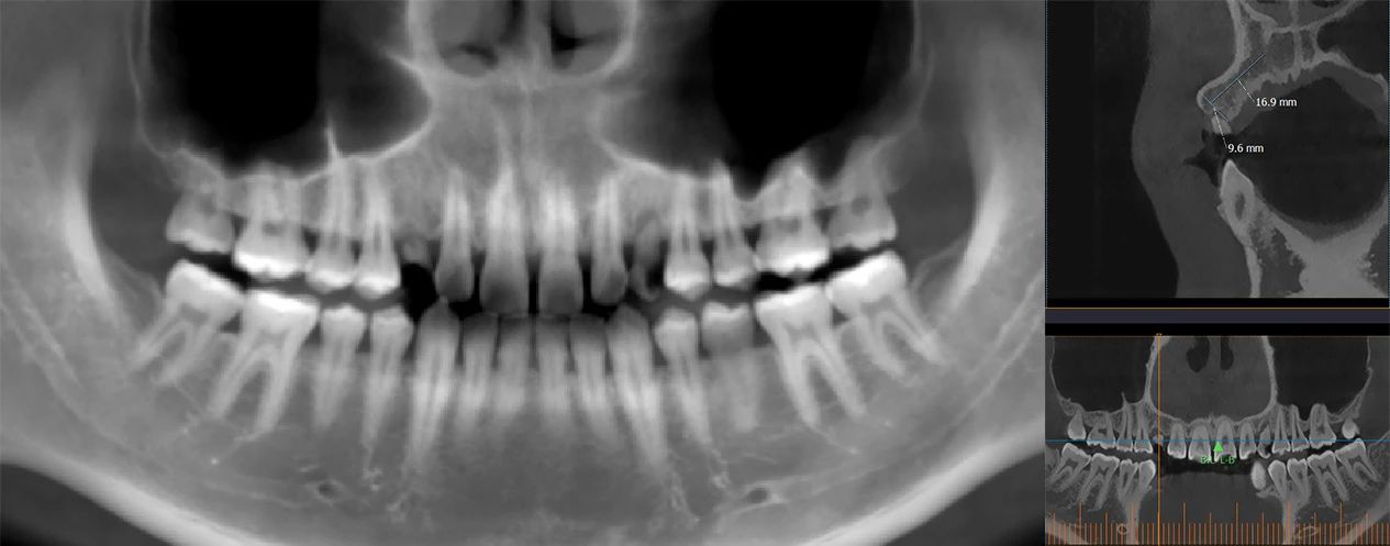 2454e69f3259275176f2272216092464