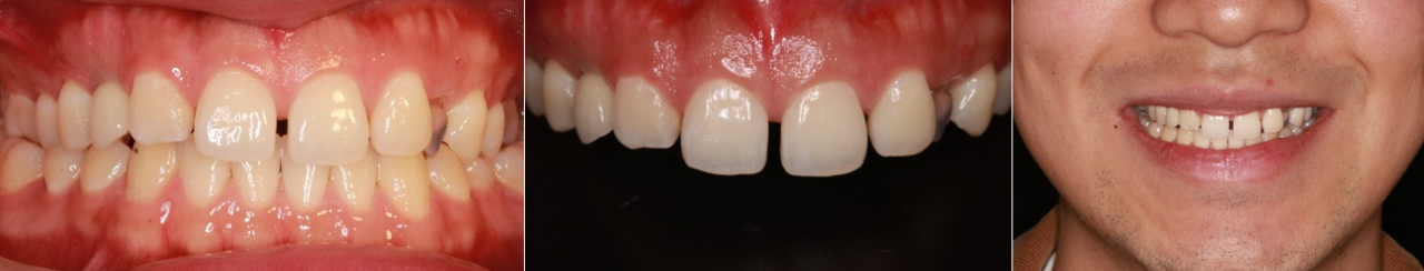 298fddeefae2ebb30f1e7df8137e6f15