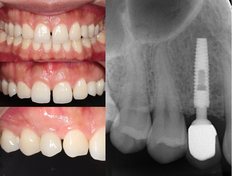 8002c09874e9d02f24fd1d122fc2bdb2